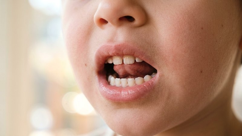 Un primerísimo plano de la boca entreabierta de un niño pequeño, con la punta de la lengua elevada hacia el paladar y lo
